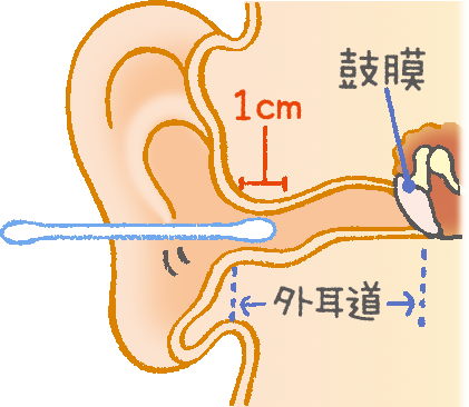 過ぎ 耳かき し 耳かきのし過ぎで汁や血が 病院には行ったのですが…